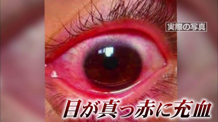 充血 病気 の 目 うさぎの目におこる5つの病気｜4つの症状から考える目の病気の原因