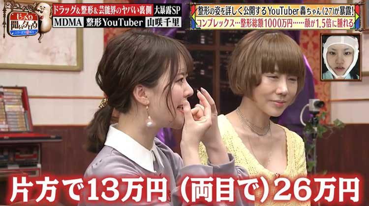 300万回再生突破 衝撃的なあご動画が話題の整形youtuber轟ちゃんが 整形の一部始終を公開 テレ東プラス 300万回再生突破 衝撃的なあご動画が話題の整形youtuber轟ちゃんが 整形の一部始終を公開 テレ東プラス