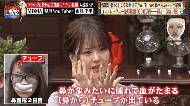 300万回再生突破 衝撃的なあご動画が話題の整形youtuber轟ちゃんが 整形の一部始終を公開 テレ東プラス 300万回再生突破 衝撃的なあご動画が話題の整形youtuber轟ちゃんが 整形の一部始終を公開 テレ東プラス