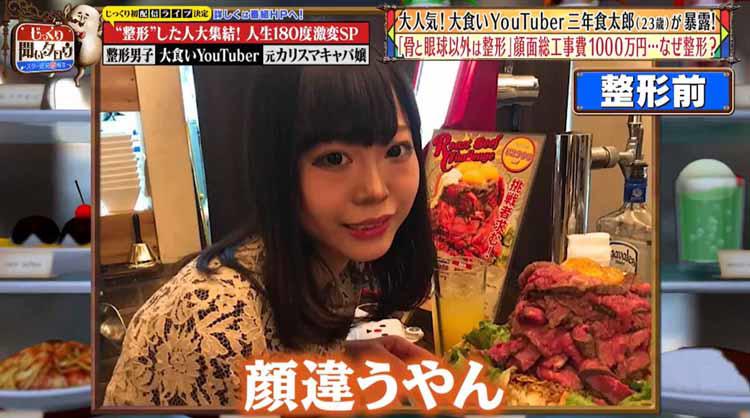 骨と眼球以外は整形」 顔面総工事費1000万円、大食いYouTuber三年食