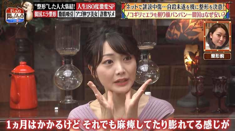 ノコギリで骨を削る 韓国エラ整形 ネットの誹謗中傷で自殺未遂 それを機に整形した元アイドル じっ テレ東プラス ノコギリで骨を削る 韓国エラ整形 ネットの誹謗中傷で自殺未遂 それを機に整形した元アイドル じっ テレ東プラス