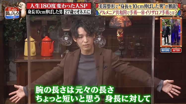 美容整形で身長を10cm伸ばした男が 衝撃の手術全貌を暴露 じっくり聞いタロウ テレ東プラス 美容整形で身長を10cm伸ばした男が 衝撃の手術全貌を暴露 じっくり聞いタロウ テレ東プラス