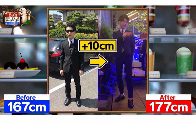 【中古】 「低身長」は手術で伸びる 画期的な骨延長治療「イリザロフ法」のすべて/現代書林/吉野宏一 Amazon.co.jp: 「低身長」は手術で伸びる ―画期的な骨延長治療