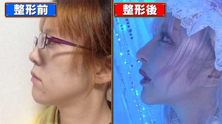 アンチからあごをいじられ心を病んだコスプレイヤーが総額ウン万円の整形 じっくり聞いタロウ テレ東プラス アンチからあごをいじられ心を病んだコスプレイヤーが総額ウン万円の整形 じっくり聞いタロウ テレ東プラス