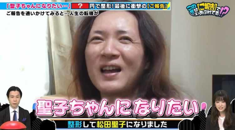 好きすぎて全身整形 憧れの松田聖子になった49歳 総額いくら 衝撃の事実も告白 テレ東プラス 好きすぎて全身整形 憧れの松田聖子になった49歳 総額いくら 衝撃の事実も告白 テレ東プラス