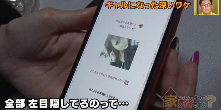 顔の左側が成長しない病気 おしゃれな眼帯をつけたギャルの真実とキラキラな夢 家 ついて行って テレ東プラス 顔の左側が成長しない病気 おしゃれな眼帯をつけたギャルの真実とキラキラな夢 家 ついて行って テレ東プラス