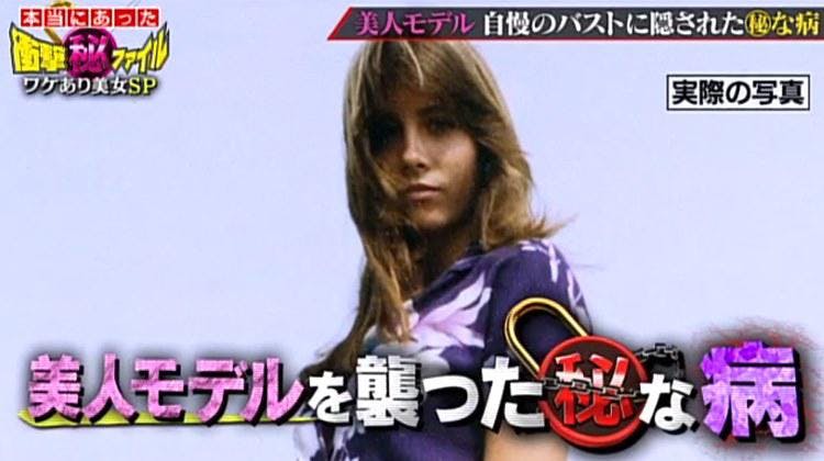 痛みそしてしびれ 乳腺炎ではない 美女モデルを襲ったまさかの病 テレ東プラス 痛みそしてしびれ 乳腺炎ではない 美女モデルを襲ったまさかの病 テレ東プラス