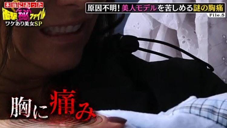 痛みそしてしびれ 乳腺炎ではない 美女モデルを襲ったまさかの病 テレ東プラス 痛みそしてしびれ 乳腺炎ではない 美女モデルを襲ったまさかの病 テレ東プラス