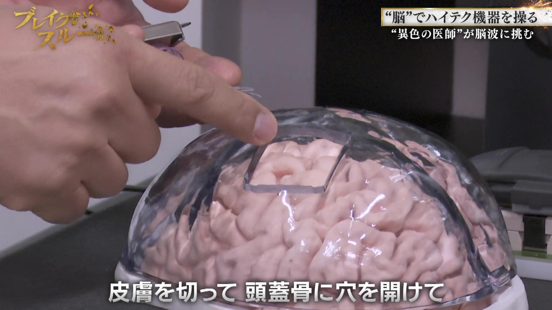 脳”でハイテク機器を操る！？ ”異色の医師”が脳波に挑む | テレ東