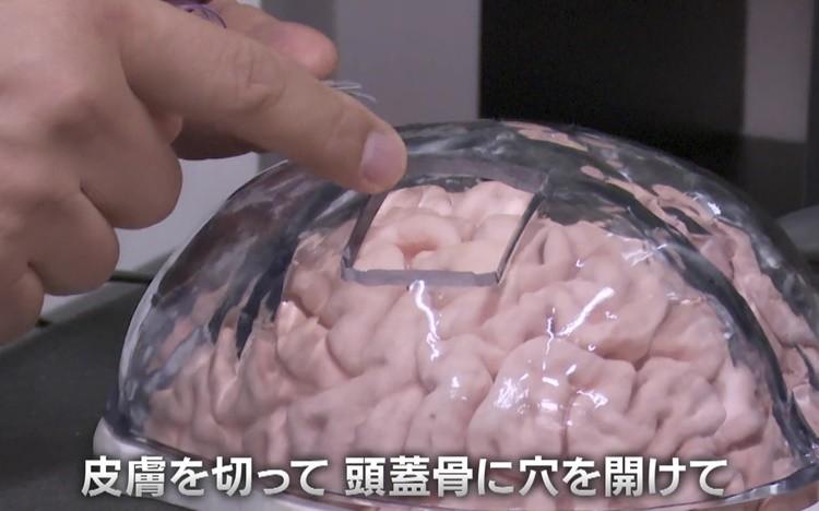 脳”でハイテク機器を操る！？ ”異色の医師”が脳波に挑む | テレ東