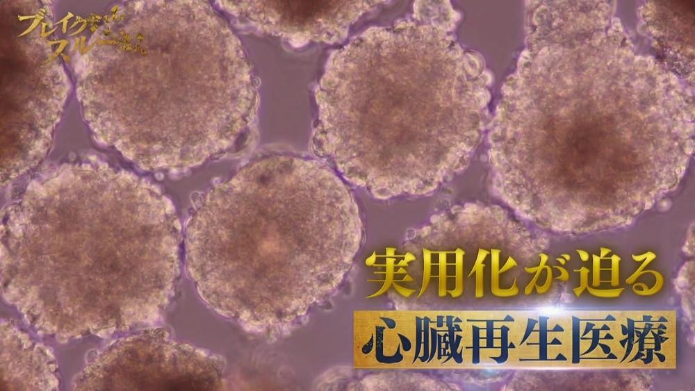 心臓再生医療”で心不全を治す！？ 培養した筋肉細胞を移植：ブレイク