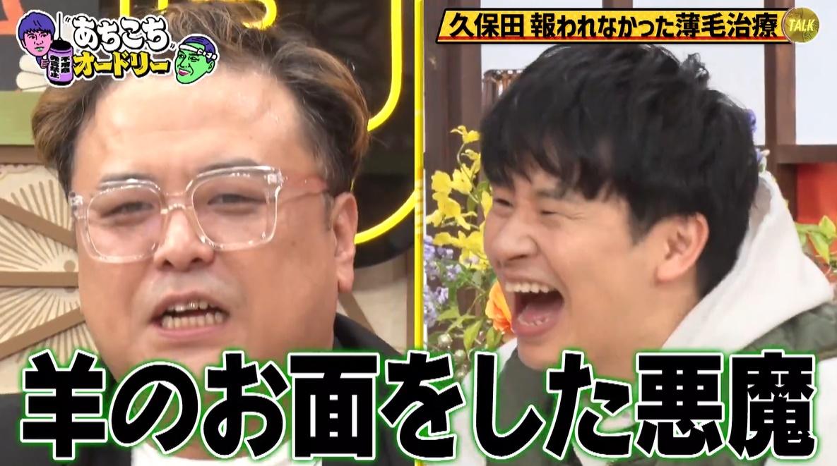 日本はハゲに批判的な国」とろサーモン久保田、報われなかった薄毛治療